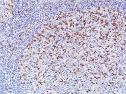 Tonsil stained with TIGIT [BC41] antibody