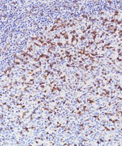 Tonsil stained with TIGIT [BC41] antibody