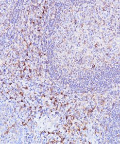 Tonsil stained with TIM3 [BLR033F] antibody