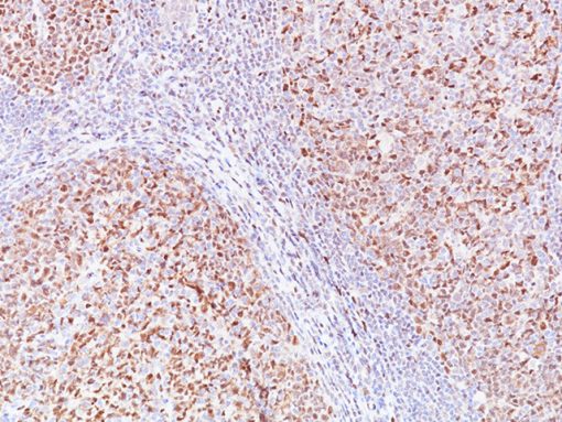 Tonsil stained with LMO2 [SP51] antibody.