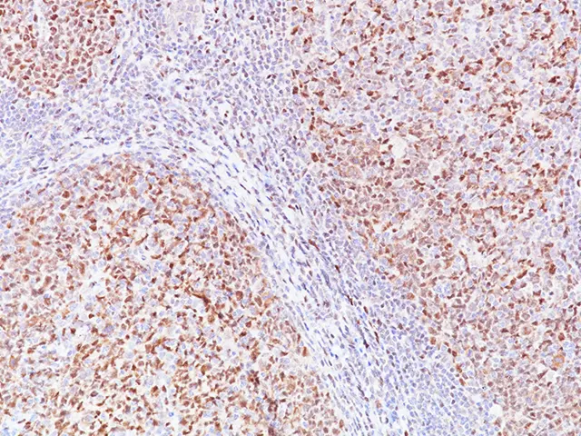 Tonsil stained with LMO2 [SP51] antibody.