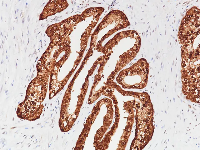 Prostate stained with PSAP [rACCP/1338] antibody