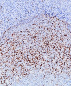Tonsil stained with CD137 [BLR051F] antibody