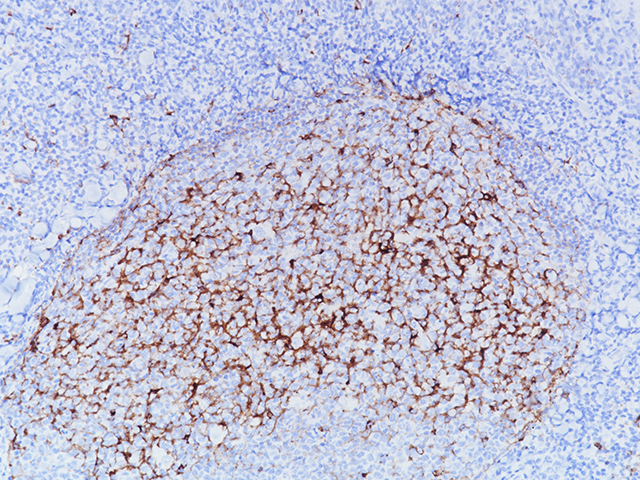 Tonsil stained with LMO2 [SP51] antibody.
