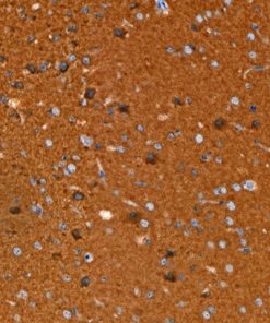 Brain stained with Pan TRK [RM423] antibody