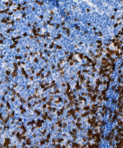 Tonsil stained with CD247 [BL-336-1B2] antibody