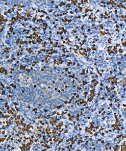 Spleen stained with Glycophorin A [JC159] antibody