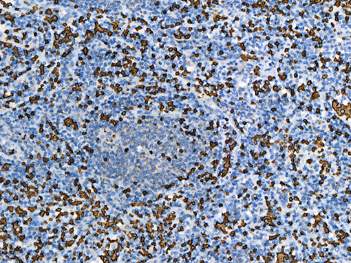 Spleen stained with Glycophorin A [JC159] antibody