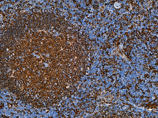 Tonsil stained with HLA-DR [TAL 1B5] antibody