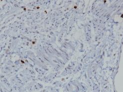 Uterus stained with Mast Cell Tryptase [AA1] antibody