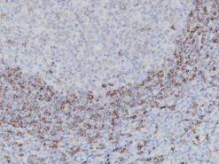Tonsil stained with Hairy Cell Leukemia [DBA.44] antibody