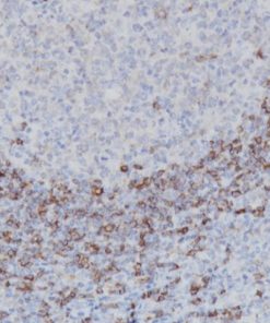 Tonsil stained with Hairy Cell Leukemia [DBA.44] antibody