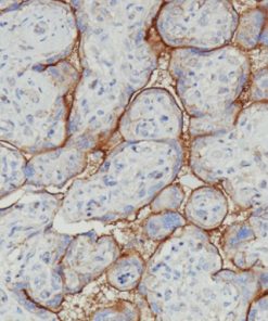 Placenta stained with CD47 [EPR21794] antibody