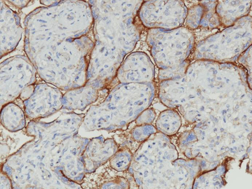 Placenta stained with CD47 [EPR21794] antibody