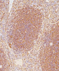 Spleen stained with HLA-B [BC43] antibody