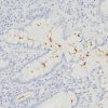 H pylori infected stomach tissue (HPY19) stained with Helicobacter pylori [EPR10353] antibody