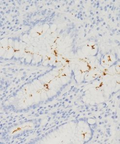 H pylori infected stomach tissue (HPY19) stained with Helicobacter pylori [EPR10353] antibody