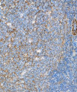Tonsil stained with CD54 [E3Q9N] antibody.