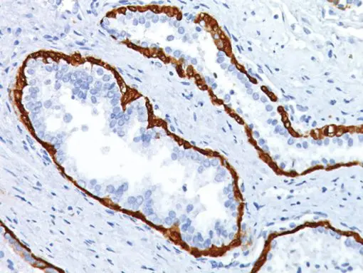 Prostate stained with Prostate - 2X