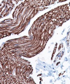 Bladder muscle stained with Smoothelin antibody