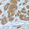Prostate stained with Prostate Specific Antigen Antibody