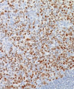Tonsil stained with BCL-6 Mouse Monoclonal Antibody