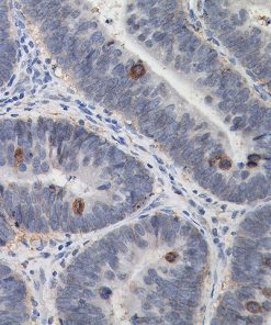 Colon stained with IGF-1R antibody