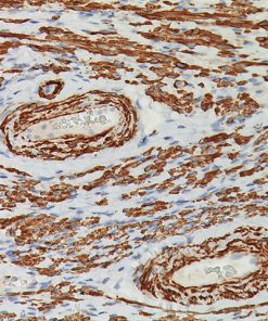 Uterus stained with Smooth Muscle Myosin Heavy Chain antibody.