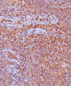 Tonsil stained with CD45RO antibody