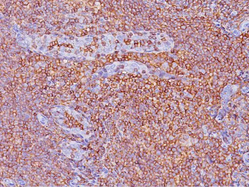 Tonsil stained with CD45RO antibody