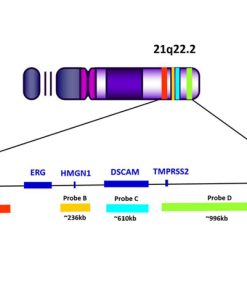 TMPRSS2 / ERG del-TECT™ Four Color