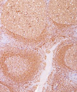 Tonsil stained with CD79a antibody