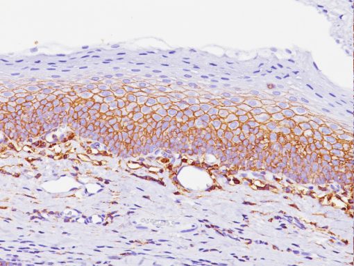 Stratified squamous epithelium stained with CD44 antibody