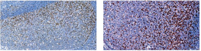 Biocare TGIT examples on tonsils 