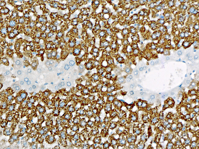 Mouse-on-Mouse: Mouse Hepatocyte Specific Antigen on mouse liver