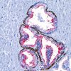 Prostate stained with PIN-4 antibody using ONCORE Pro Hematoxylin