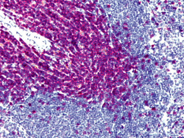 Rabbit-on-Rodent: Rabbit CD3 on Mouse Spleen