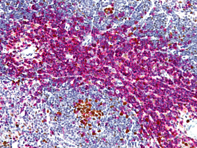 Mouse-on-Mouse Avidin-Biotin Biotinylation Double Stain Kit: Mouse PCNA + Rabbit CD3 on mouse spleen