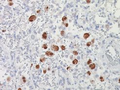 Cytomegalovirus (CMV) Probe - Staining CMV infected lung cells