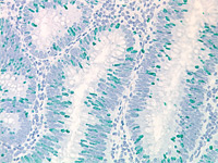  Vina Green Chromogen Kit staining colon cancer with Ki-67