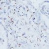 Spirochete infected tissue stained with Treponema pallidum antibody (Spirochete)