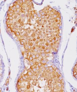 Testicular tissue stained with Inhibin Alpha antibody