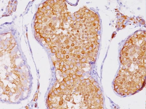 Testicular tissue stained with Inhibin Alpha antibody