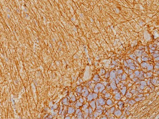 Brain stained with Glial Fibrillary Acidic Protein antigen (P)