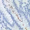 Small intestine stained with Helicobacter pylori Antibody