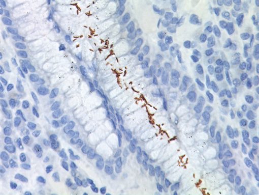 Small intestine stained with Helicobacter pylori Antibody