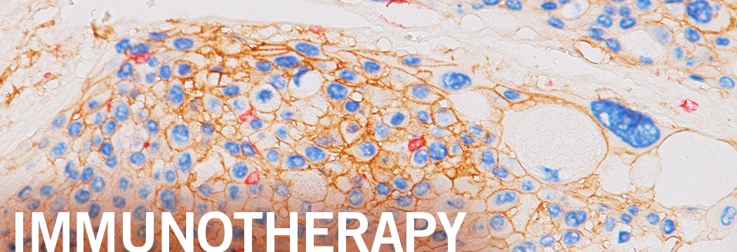 immunotherapy-ihc-banner