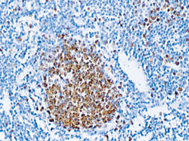 ki67 biocare medical ki67 staining