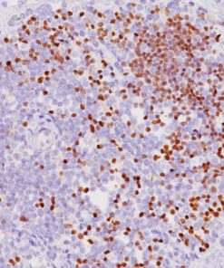 Thymus stained with Terminal Deoxynucleotidyl Transferase antibody (TdT{P})
