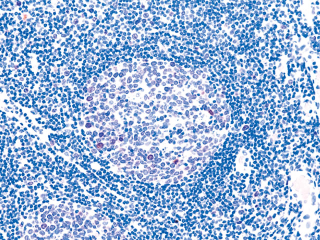 Competitor: Dextran backbone polymer, 1:200 dilution